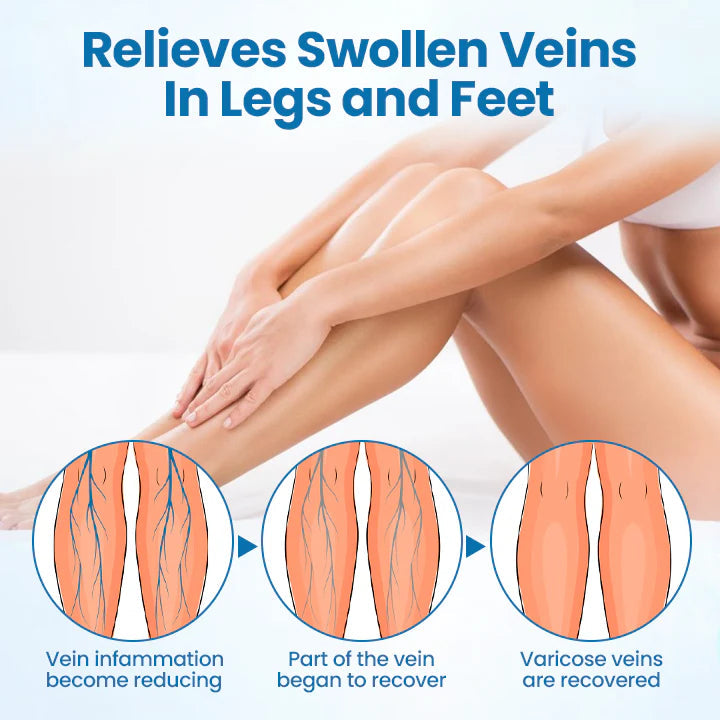 Natravor® VeinGuard Herbal Spray-✅ Clinically proven to eliminate varicose veins in just 7 days!