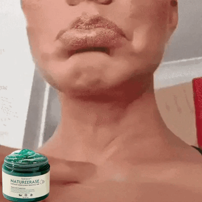 Natravor™ NatureErase Instant Mole & Spot Removal Gel