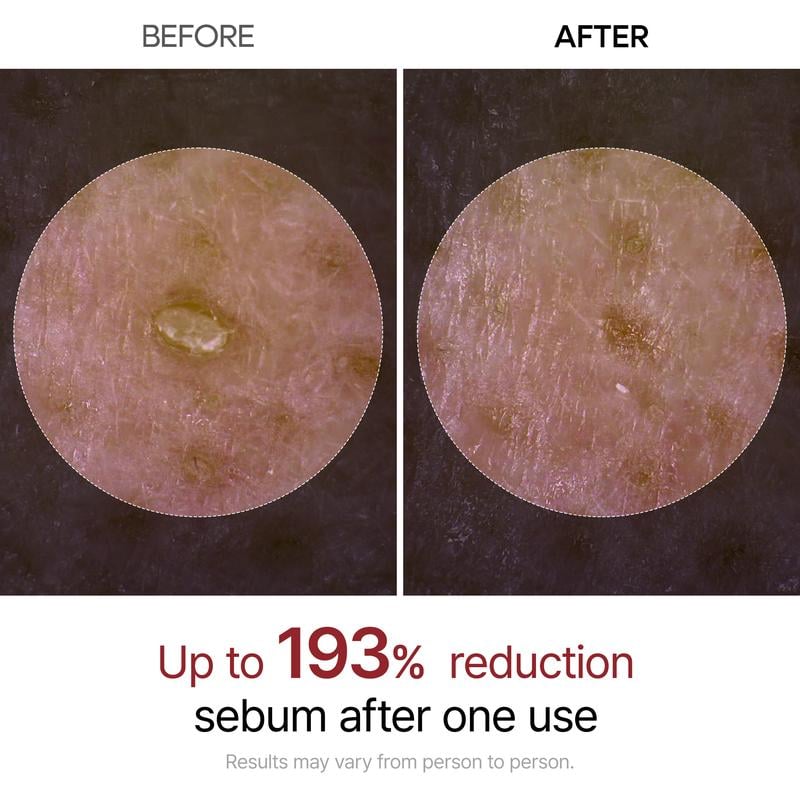 Peel Shot Glow Rice Ampoule Duo - Serums for Brightening, Exfoliating, and Moisturizing🌾