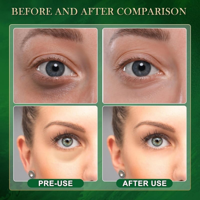 🥑Summer Hot Sale 🔥 Avocado Moisturizing Collagen Eye bagMask,60pcs/set